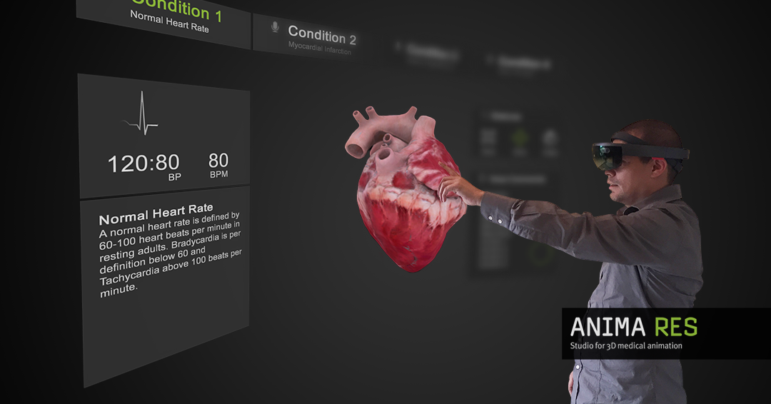 HoloLens - Mixed Reality
